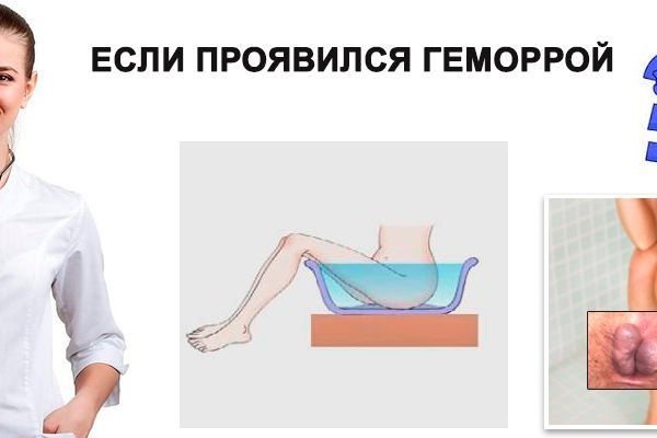 Кракен как войти через тор